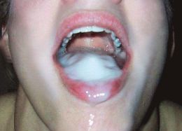 %al%